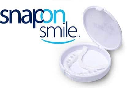 Snap-on Smile Produkto peržiūra. Kas tai?